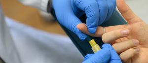 Im Labor wird einer Person Blut für einen HIV-Test entnommen (Symbolbild).