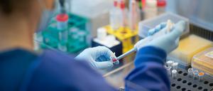 Aus Abwasserproben wird RNA-Material extrahiert und auf das Coronavirus getestet - hier eine Aufnahme aus Hamburg.