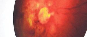 Auge des Sturms. Eva Meckbach in Castelluccis Hölderlin-Vision. Foto: Joachim Fieguth