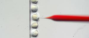 Die Mikroskopieaufnahme des Max-Delbrück-Centrum für Molekulare Medizin zeigt eine Mikroinjektion von Zebrafischembryonen. Hier wird mit dem CRISPR/Cas9-Verfahren gearbeitet.