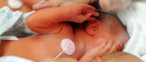 Perinatalzentren sind auf die besondere Situation von Frühgeborenen spezialisiert.