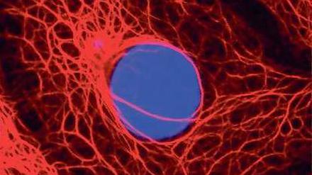 Ein paar falsche Genbausteine im Erbgut (blau) einer Zelle, können das Risiko, an Brustkrebs zu erkranken, erheblich steigern. Per Gentests lassen sich diese Mutationen nachweisen, doch damit ist längst nicht klar, was dann zu tun ist.
