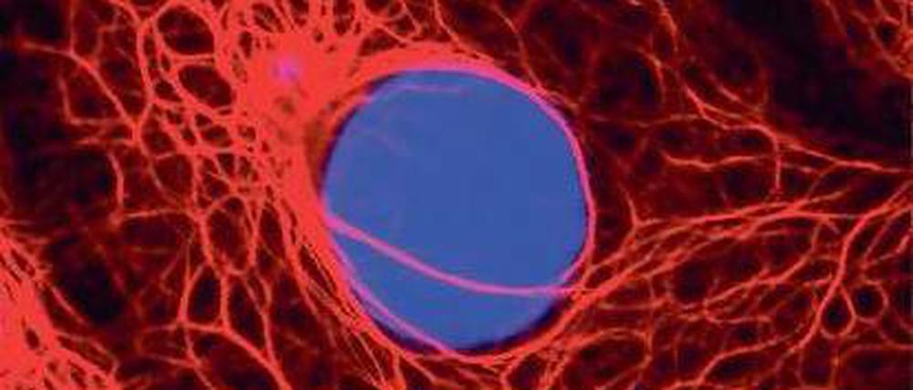 Ein paar falsche Genbausteine im Erbgut (blau) einer Zelle, können das Risiko, an Brustkrebs zu erkranken, erheblich steigern. Per Gentests lassen sich diese Mutationen nachweisen, doch damit ist längst nicht klar, was dann zu tun ist.