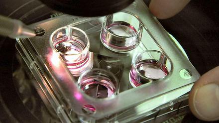 Präimplantationsdiagnostik (PID) ist keine Kassenleistung, entschied das Bundessozialgericht.