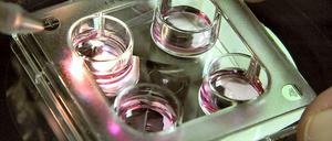 Präimplantationsdiagnostik (PID) ist keine Kassenleistung, entschied das Bundessozialgericht.