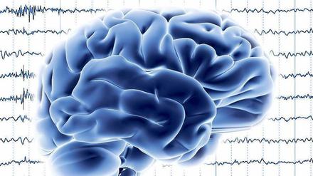 Wenn das Elektroenzephalogramm keine Nervenimpulse mehr misst und die Nulllinien den Hirntod belegen, erst dann dürfen Mediziner Organe für eine Transplantation entnehmen. 