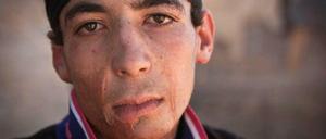 Kriegsopfer: Mohammad (17) lebt heute in einem Flüchtlingscamp.