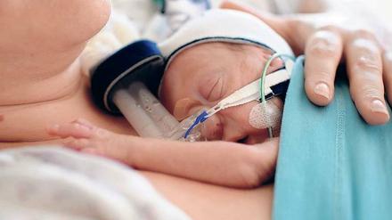 Vorbild Tierreich. Alle Kängurubabys sind Frühchen. Sie reifen nach der Geburt im Beutel des Muttertiers. Auch für den Menschen sei diese Methode geeignet, sagen Ärzte. Die Frühgeborenen würden im Schnitt eher aus der Klinik entlassen.