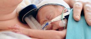 Vorbild Tierreich. Alle Kängurubabys sind Frühchen. Sie reifen nach der Geburt im Beutel des Muttertiers. Auch für den Menschen sei diese Methode geeignet, sagen Ärzte. Die Frühgeborenen würden im Schnitt eher aus der Klinik entlassen. 