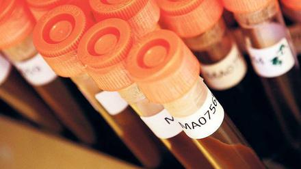 Die Pharmabranche hat in den vergangenen Jahren geglaubt, es gebe genug Antibiotika. Doch viele wirken nicht mehr.