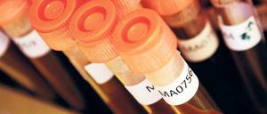 Die Pharmabranche hat in den vergangenen Jahren geglaubt, es gebe genug Antibiotika. Doch viele wirken nicht mehr.