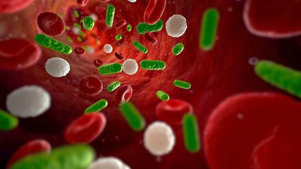 Vergiftet. Bei Sepsis gelangen Bakterien, Viren und Pilze in den Kreislauf und breiten sich im ganzen Körper aus.