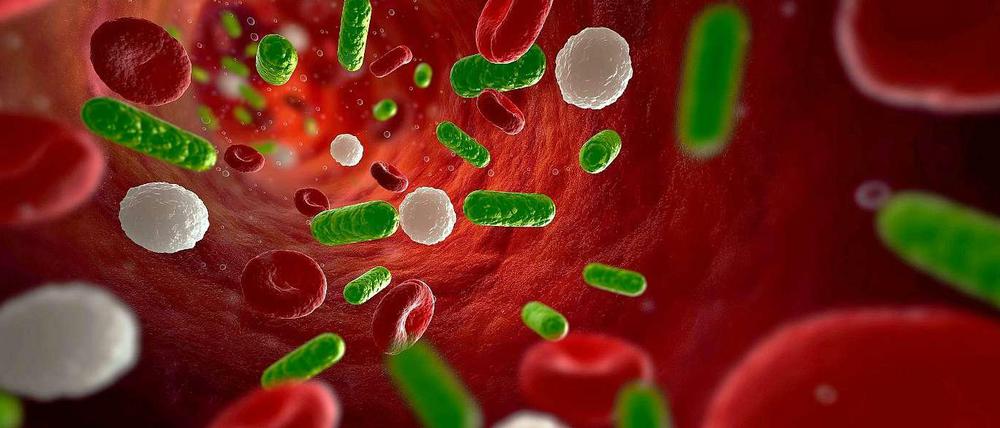 Vergiftet. Bei Sepsis gelangen Bakterien, Viren und Pilze in den Kreislauf und breiten sich im ganzen Körper aus.