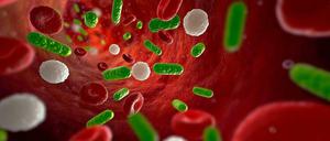 Vergiftet. Bei Sepsis gelangen Bakterien, Viren und Pilze in den Kreislauf und breiten sich im ganzen Körper aus.
