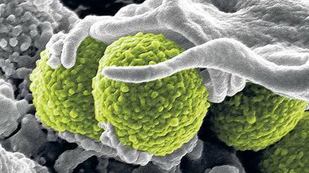 Gefahr im Krankenhaus. Im Volksmund werden „MRSA“ auch Krankenhausbakterien genannt. Im Klinikalltag mangelt es vielfach an elementaren Hygienemaßnahmen wie Händedesinfektion. 