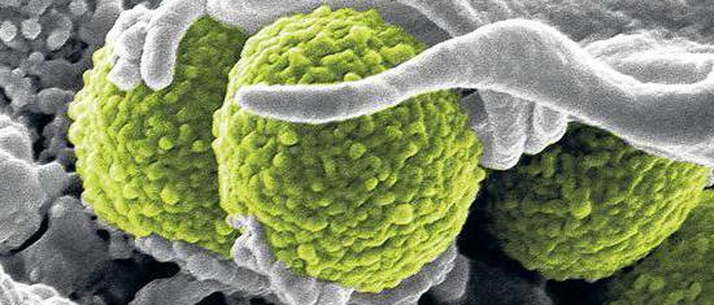 Gefahr im Krankenhaus. Im Volksmund werden „MRSA“ auch Krankenhausbakterien genannt. Im Klinikalltag mangelt es vielfach an elementaren Hygienemaßnahmen wie Händedesinfektion.