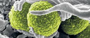 Gefahr im Krankenhaus. Im Volksmund werden „MRSA“ auch Krankenhausbakterien genannt. Im Klinikalltag mangelt es vielfach an elementaren Hygienemaßnahmen wie Händedesinfektion. 