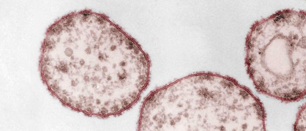 Masernvirus