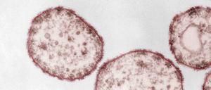 Masernvirus