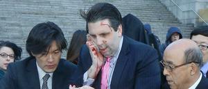 US-Botschafter Mark Lippert nach der Messerattacke in Südkorea.