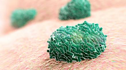 Aus Affenpocken werden mpox