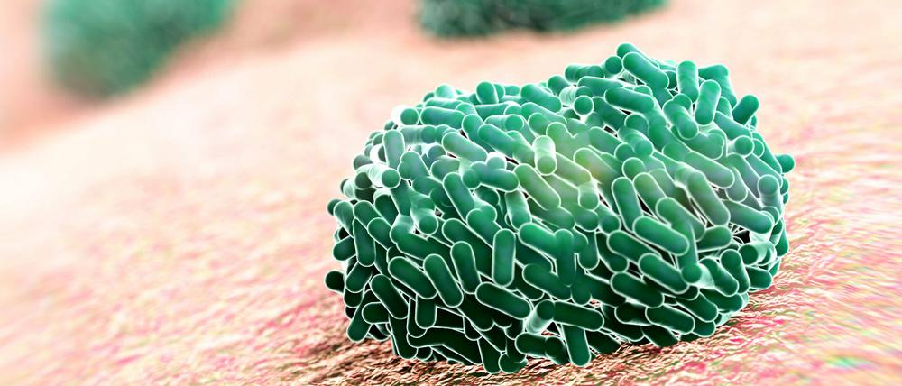 Aus Affenpocken werden mpox