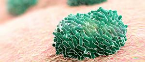 Aus Affenpocken werden mpox