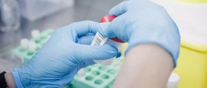 2916 nachgewiesene Infektionen mit Affenpocken gibt es in Deutschland.