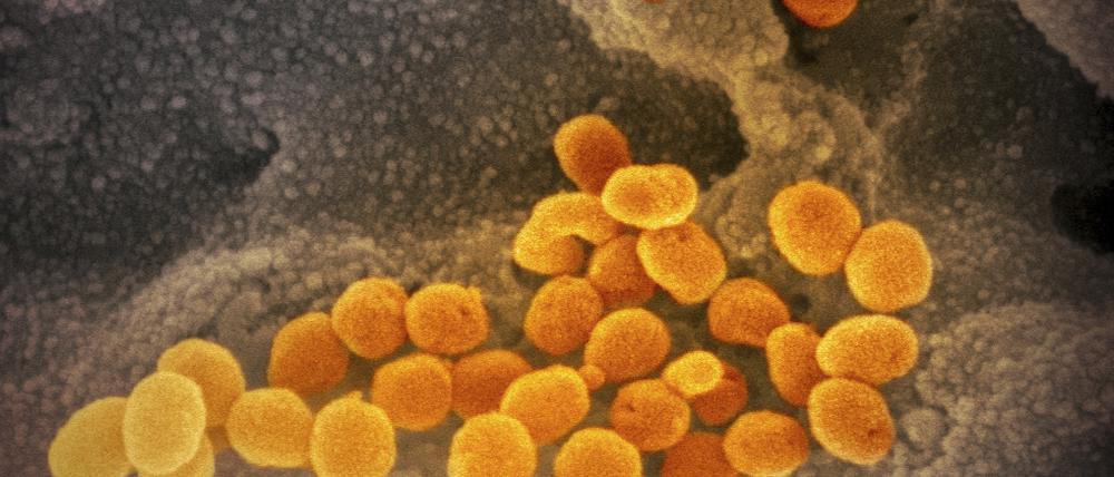 Interferon scheint in Kombination mit antiviralen Medikamenten in Zellkulturen hochwirksam gegen das Coronavirus zu sein. 