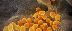 Interferon scheint in Kombination mit antiviralen Medikamenten in Zellkulturen hochwirksam gegen das Coronavirus zu sein. 