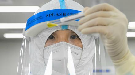 Todesfälle im Zusammenhang mit dem neuen Langya-Henipavirus (LayV) sind bisher nicht bekannt. 