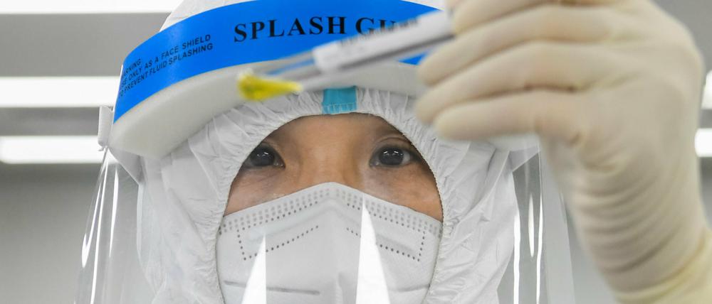 Todesfälle im Zusammenhang mit dem neuen Langya-Henipavirus (LayV) sind bisher nicht bekannt. 