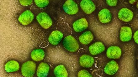Das "Affenpocken"-Virus.