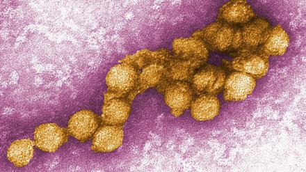 Eine elektronenmikroskopische Aufnahme des West-Nil-Virus.