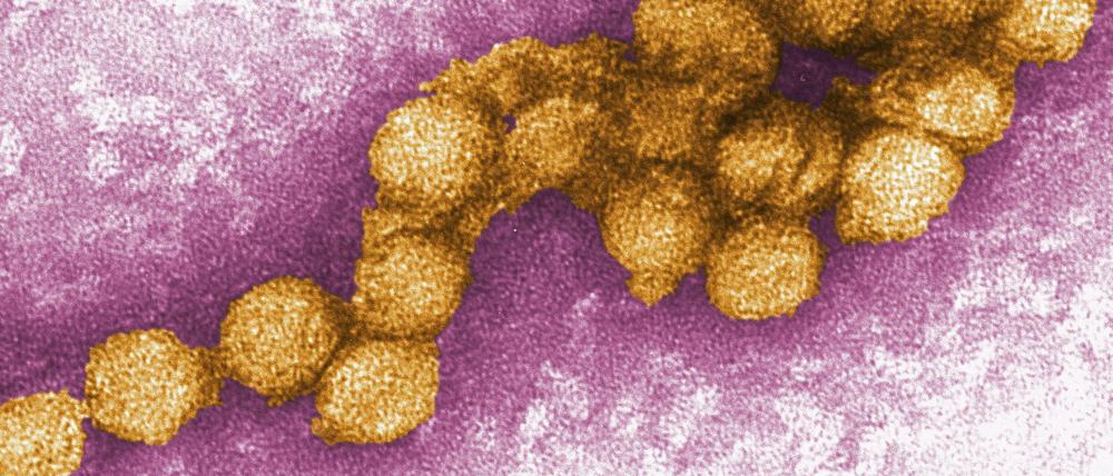 Eine elektronenmikroskopische Aufnahme des West-Nil-Virus.