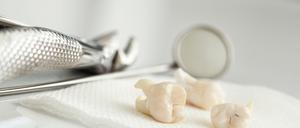 Gezogene Zähne liegen auf einem Tablett.