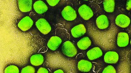 Eine kolorierte transmissionselektronenmikroskopische Aufnahme von Partikeln des Affenpockenvirus (grün), kultiviert und gereinigt aus einer Zellkultur, aufgenommen in der NIAID Integrated Research Facility, veröffentlicht am 26. Juli 2022 in Fort Detrick, Maryland. 