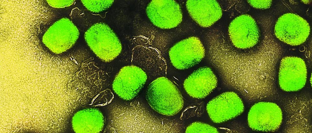 Eine kolorierte transmissionselektronenmikroskopische Aufnahme von Partikeln des Affenpockenvirus (grün), kultiviert und gereinigt aus einer Zellkultur, aufgenommen in der NIAID Integrated Research Facility, veröffentlicht am 26. Juli 2022 in Fort Detrick, Maryland.