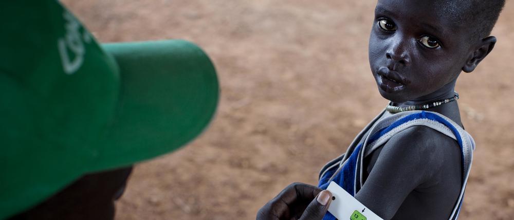 Hunger im Südsudan. Ein Mann misst den Armumfang eines Jungen in einer Nothilfeeinrichtung.
