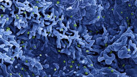 Eine rasterelektronenmikroskopische Aufnahme des MPX-Virus (grün), veröffentlicht am 26. Juli 2022.