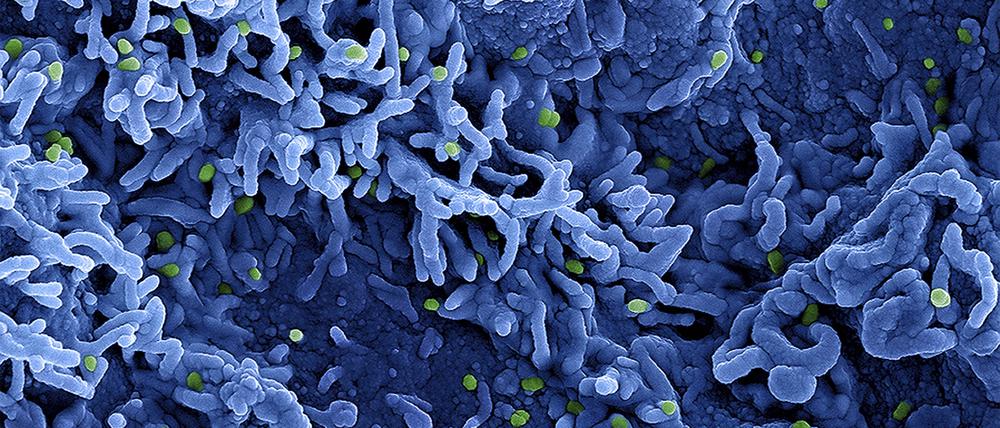 Eine rasterelektronenmikroskopische Aufnahme des MPX-Virus (grün), veröffentlicht am 26. Juli 2022.