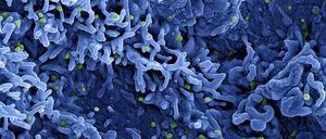 Eine rasterelektronenmikroskopische Aufnahme des MPX-Virus (grün), veröffentlicht am 26. Juli 2022.