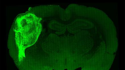Menschliches Organoid (fluoreszierend) in Schnitt von Rattenhirn.