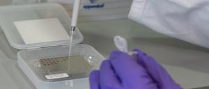 Pipettieren der Probe auf das Target (Detail)