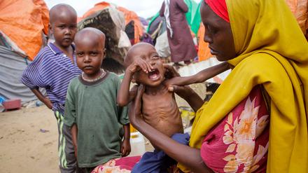 Bereits vor zwei Jahren führten Dürre und Trockenheit in Somalia zu Mangelernährung und Gesundheitsschäden.