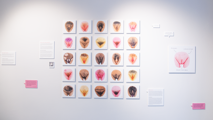 Die Vulvalippen-OP wird immer gefragter. Eine Ausstellung in Berlin-Charlottenburg soll aufklären über die Vielfalt von Vulven.