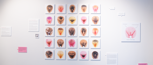 Die Vulvalippen-OP wird immer gefragter. Eine Ausstellung in Berlin-Charlottenburg soll aufklären über die Vielfalt von Vulven.