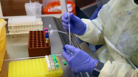 Wegen der fehlerhaften Auswertung könnten sich 55.000 Menschen zusätzlich mit dem Coronavirus infiziert haben (Symbolbild).