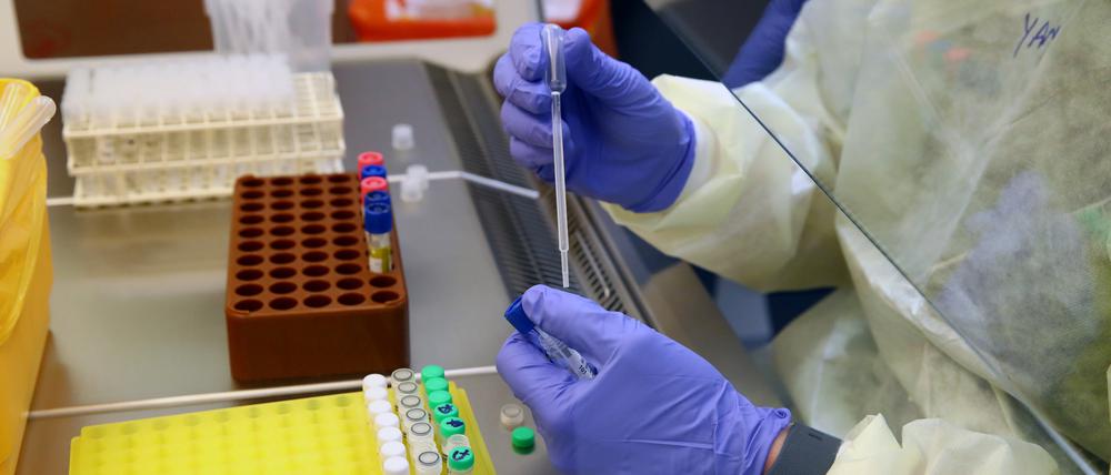 Wegen der fehlerhaften Auswertung könnten sich 55.000 Menschen zusätzlich mit dem Coronavirus infiziert haben (Symbolbild).