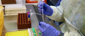 Wegen der fehlerhaften Auswertung könnten sich 55.000 Menschen zusätzlich mit dem Coronavirus infiziert haben (Symbolbild).
